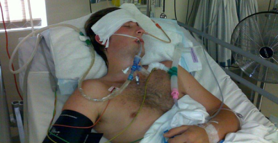 Dylan came out of a coma after two weeks. His five weeks in ICU were touch and go. 